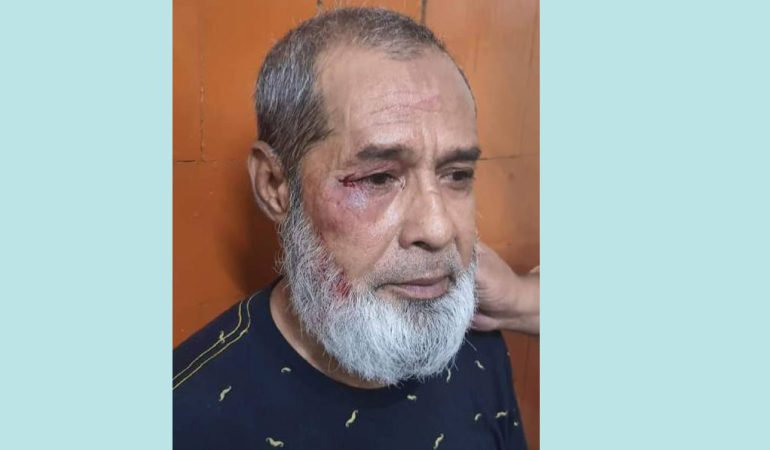 জামালপুরে আ.লীগের নেতার ওপর হামলা, ছাত্রদল নেতা আটক