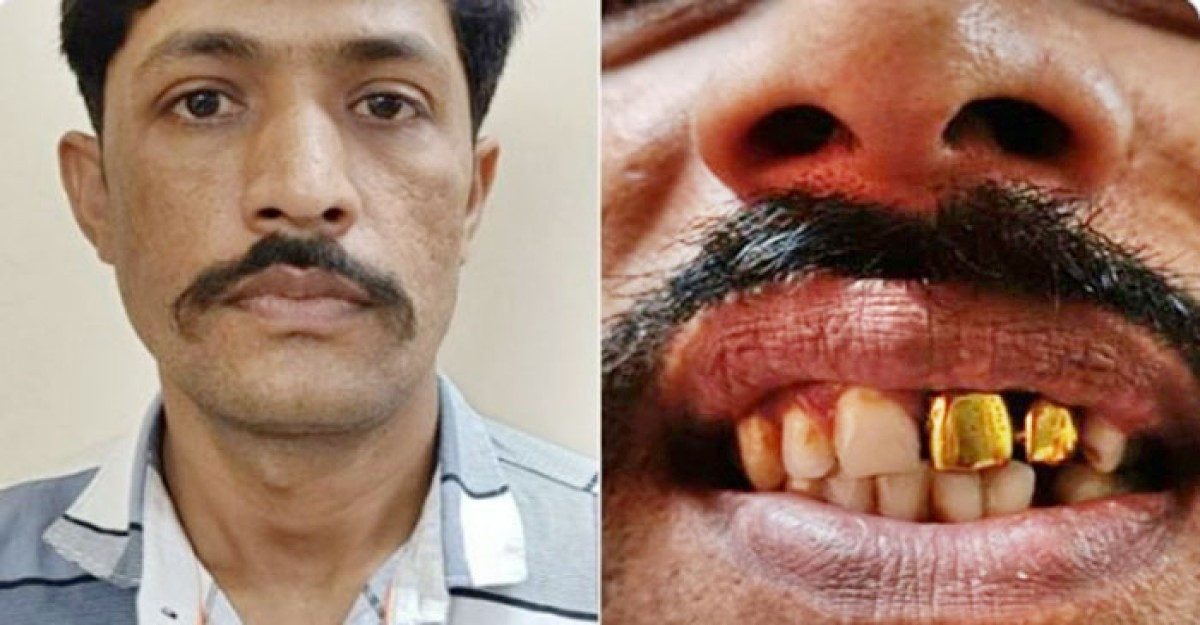 দাঁত দেখে আসামীকে গ্রেফতার করলো পুলিশ