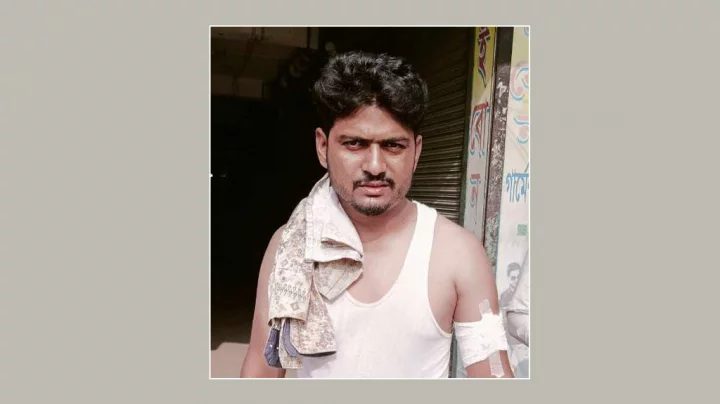 নাটোরে টিসিবি কার্ড বিতরণ নিয়ে দুগ্রুপের সংঘর্ষ, গুলিবিদ্ধ ১