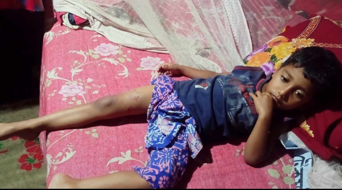 দেবীগঞ্জে কুকুরের কামড়ে আহত ৫ বছরের শিশু,আতংকে এলাকাবাসী