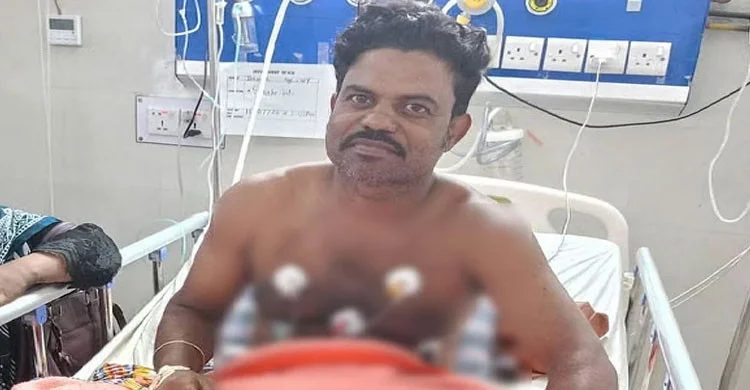 কুষ্টিয়ায় সাপের কামড় খেয়ে নিজেই হাসপাতালে ‘বিষঝাড়া ওঝা’