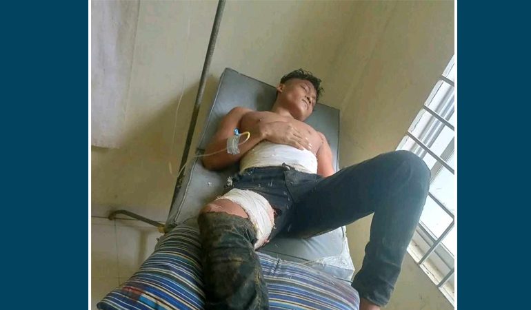 বান্দরবানে চাঁদা তুলতে এসে কেএনএফ সদস্য গুলিবিদ্ধ