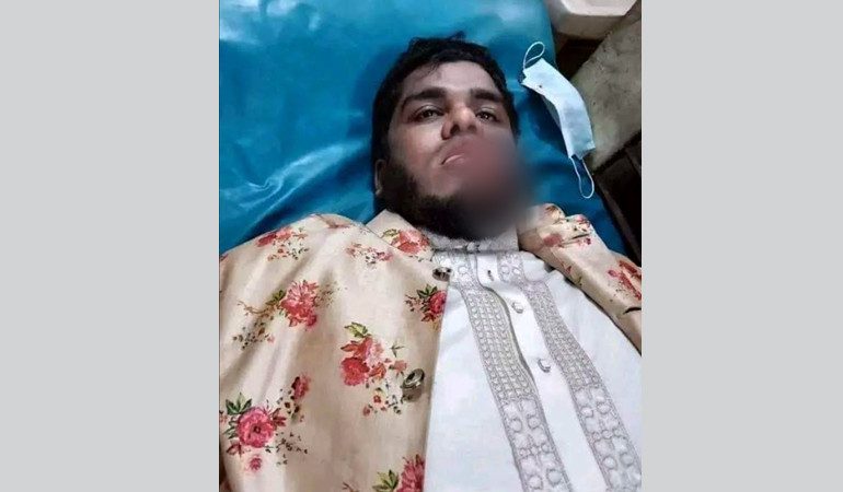 ব্রাহ্মণবাড়িয়ায় ইসলামি বক্তার ওপর হামলা, জিভ কর্তন