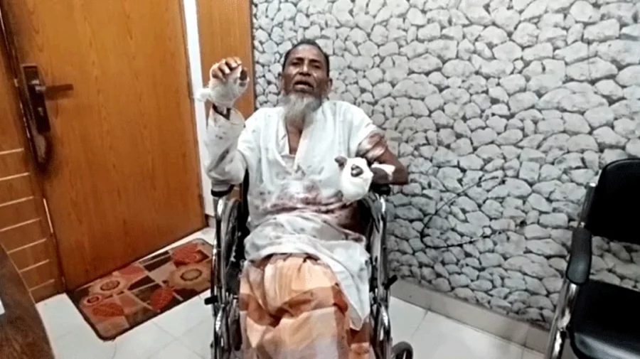 বাবার হাত-পায়ের রগ কাটার অভিযোগ ছেলের বিরুদ্ধে