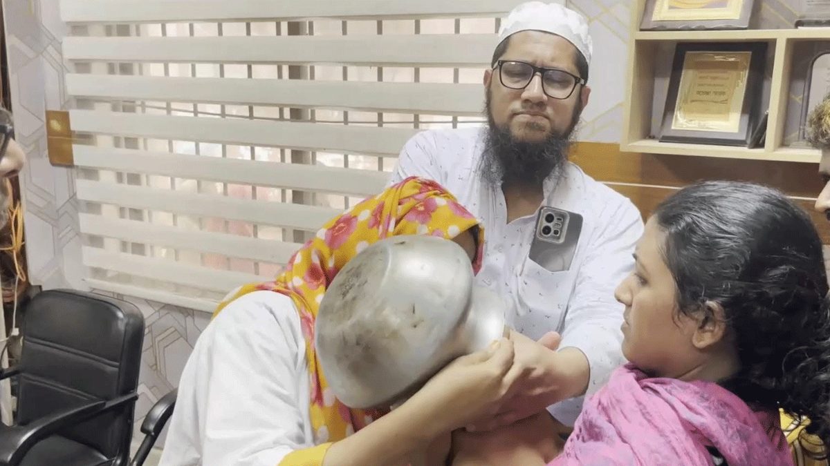 শিশুর মাথায় আটকে গেল পাতিল, ওয়ার্কশপে নিয়ে অপসারণ