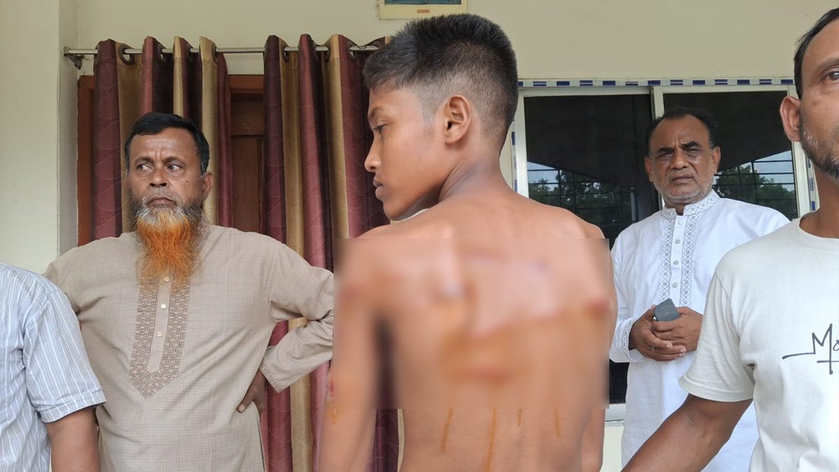 পড়া না পারায় ছাত্রকে পিটিয়ে আহত করলেন শিক্ষক