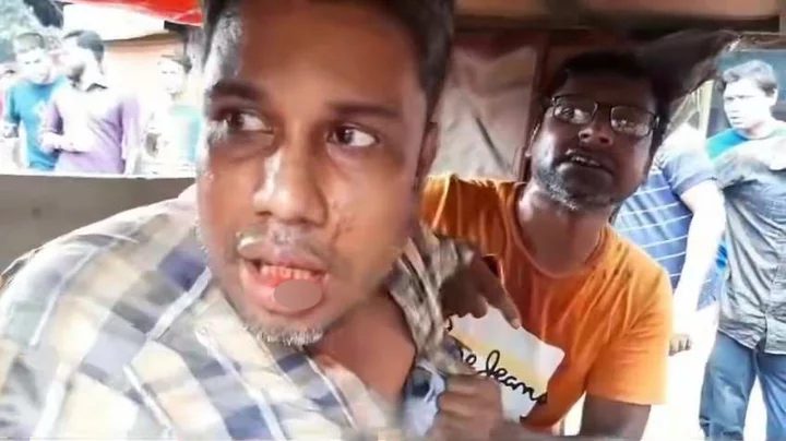অটোচালকের হাতুড়িপেটায় মোটারসাইকেল চালকের ভাঙল ৫ দাঁত