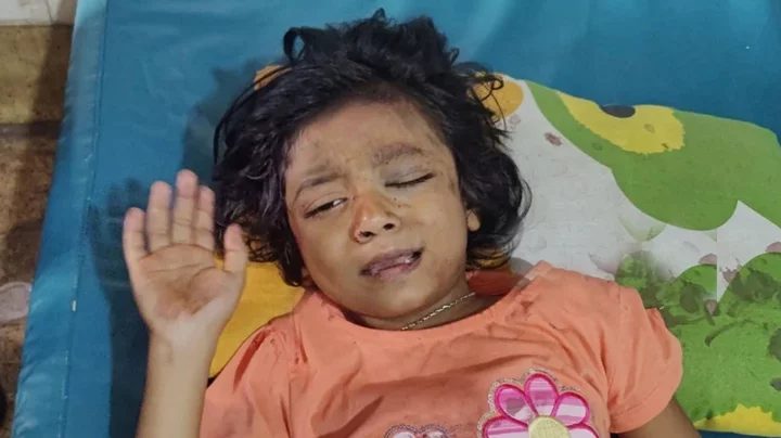 হাসপাতালে শুধু বাবার নাম বলতে পারছে ৬ বছরের শিশুটি