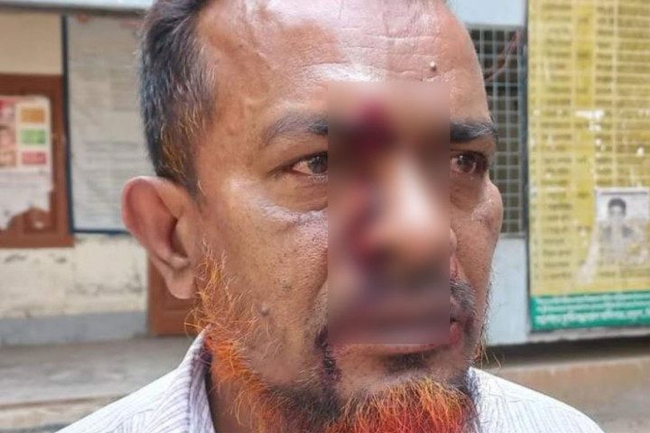 বিদায় অনুষ্ঠানে প্রধান শিক্ষককে পেটালেন সহকারী শিক্ষক