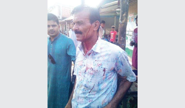 জামালপুরে আ.লীগ নেতার নেতৃত্বে বিএনপি নেতার উপর হামলা