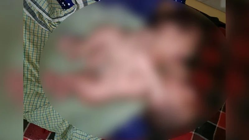 পাবনায় বুক-পেট জোড়া লাগানো যমজ শিশুর জন্ম
