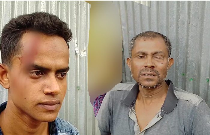 জমির সীমানা নির্ধারণকে কেন্দ্র করে হামলা, নারীসহ আহত ৪