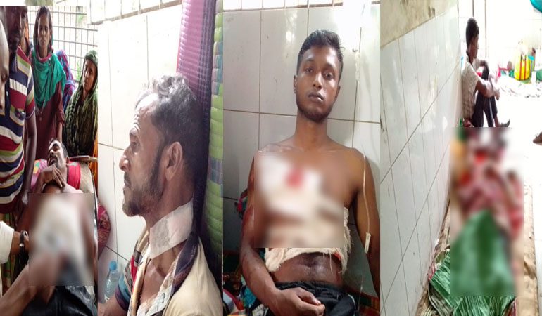 হত্যা মামলার আসামি জামিনে বাড়ি ফেরায় সংঘর্ষ, আহত ৪