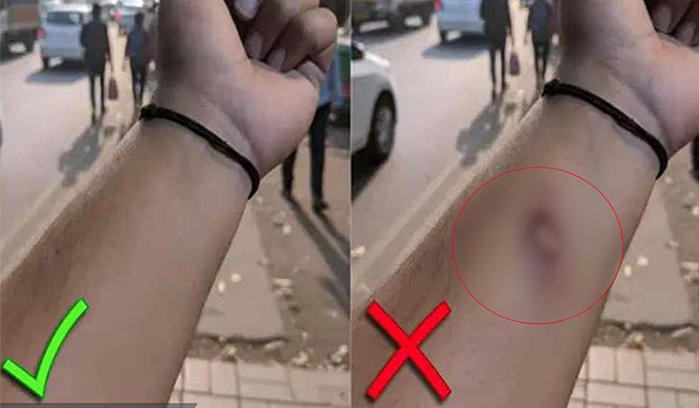 এআই দিয়ে আহত হাতের ছবি বানিয়ে অফিস ছুটি নিলেন কর্মী