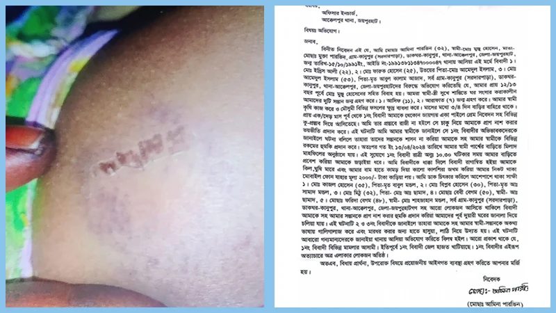 ঘরে ঢুকে গৃহবধূকে শ্লীলতাহানী ও মারধরের অভিযোগ,অতঃপর...