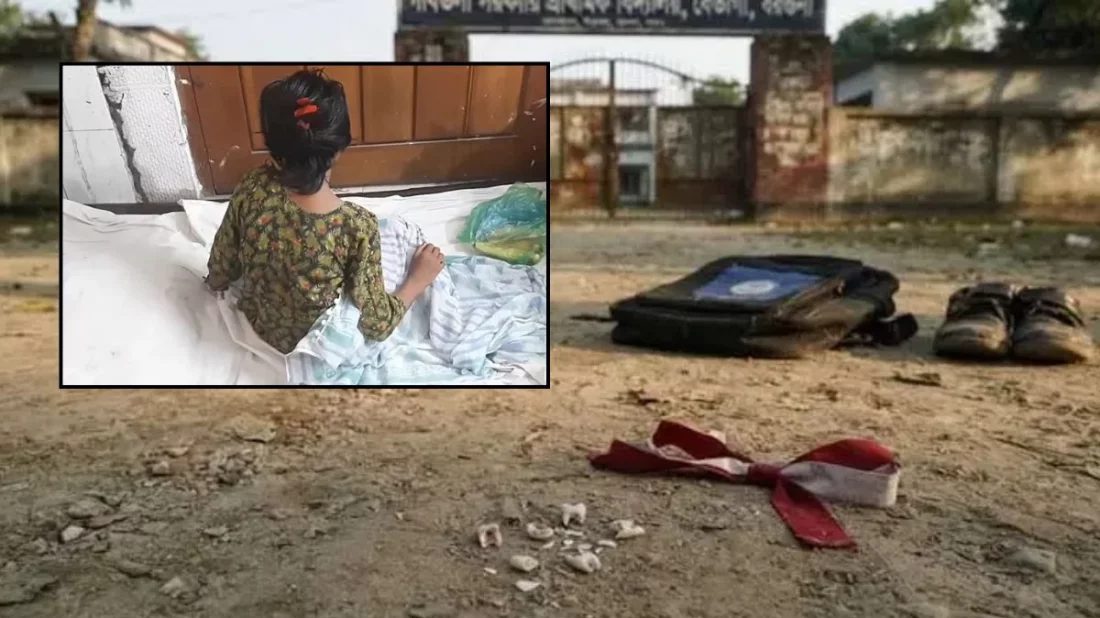 বখাটের চড়–লাথিতে দাঁত ভেঙে গেল পঞ্চম শ্রেণির ছাত্রীর